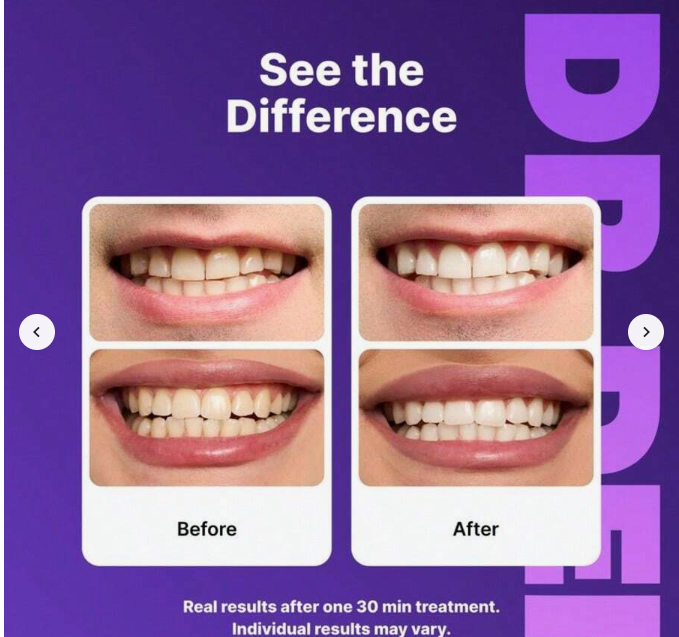 Purple Teeth Whitening Strips, 14Pcs Professional Dental Stain Remover, Peroxide-Free Sensitive Teeth Whitener, Rapid Whitening Patches For Coffee/Tea Smokers, 30-Min Instant Result Daily Dental Care.