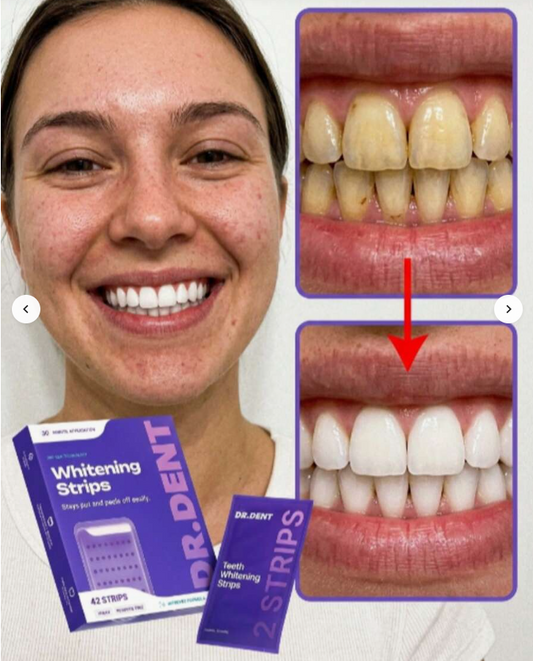 Purple Teeth Whitening Strips, 14Pcs Professional Dental Stain Remover, Peroxide-Free Sensitive Teeth Whitener, Rapid Whitening Patches For Coffee/Tea Smokers, 30-Min Instant Result Daily Dental Care.